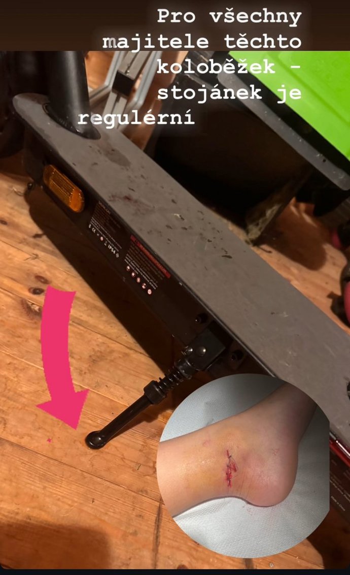 Ben Vojtek skončil s roztrženou nohou.