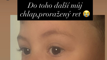 FOTO: Syn Sebastian si rozsekl ret.