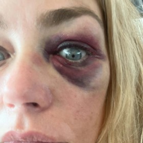 Denise Richards měl údajně zmlátit její manžel Aaron Phypers.