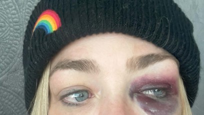 FOTO: Denise Richards měl údajně zmlátit její manžel Aaron Phypers.