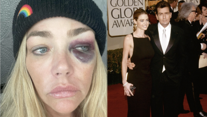 FOTO: Denise Richards má monokly.