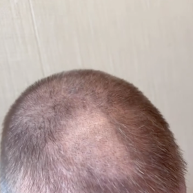 David Beckham a jeho zkažený buzz-cut.