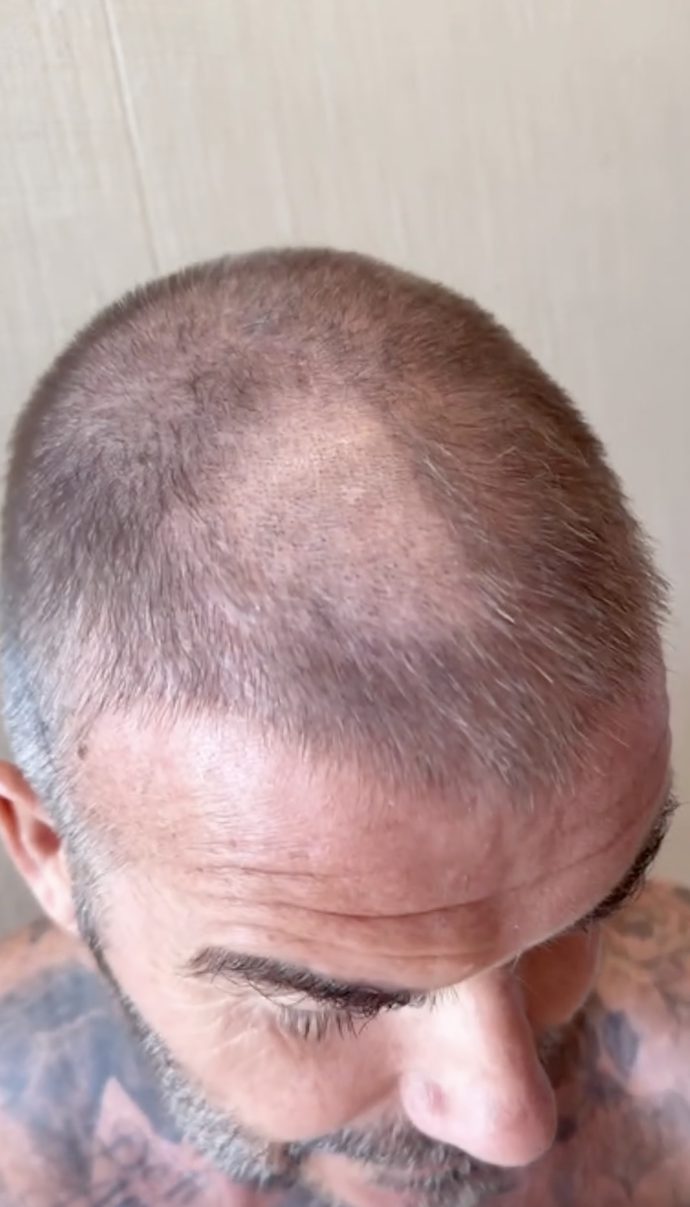 David Beckham a jeho zkažený buzz-cut.