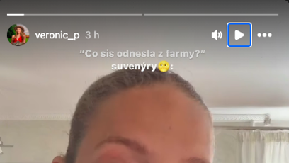 FOTO: Veve ukázala zranění, která si odnesla z Farmy.