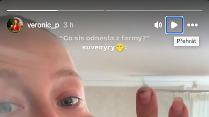 FOTO: Veve ukázala zranění, která si odnesla z Farmy.