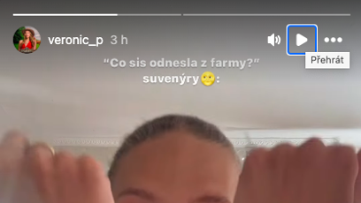 FOTO: Veve má ruce samý škrábanec.
