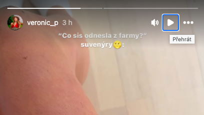 FOTO: Veve ukázala zranění, která si odnesla z Farmy.