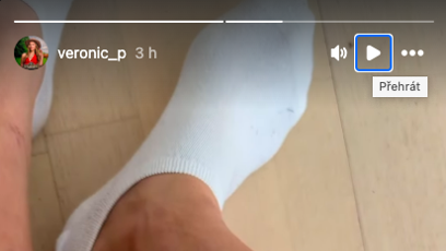 FOTO: Po reality show Farma je Veve celá od modřin a škrábanců.