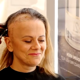 Laďka Něrgešová ukázala velkou jizvu.