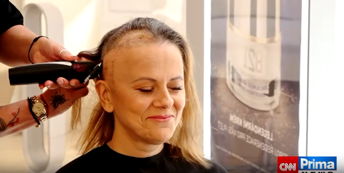 Laďka Něrgešová ukázala velkou jizvu.