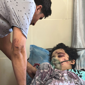 Chirurg lékařů bez hranic Ahmed Sejam se svým zraněným synem Karimem. 
