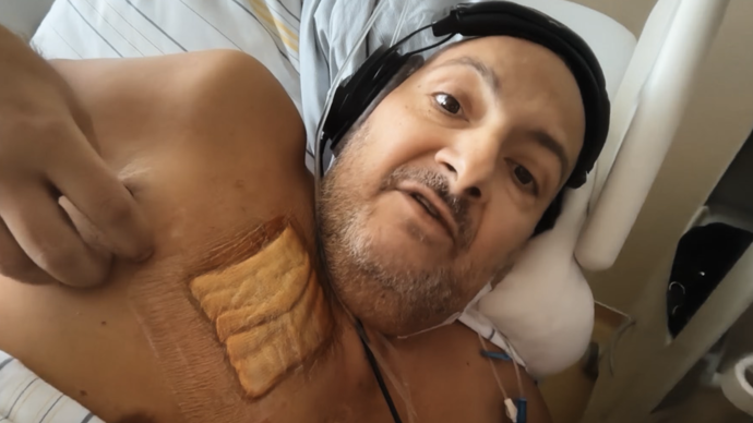 Patrik Hezucký má na hrudi zvláštní náplast. Může jít o zranění, ale i o krytí dávkovače pro určitý druh terapie.