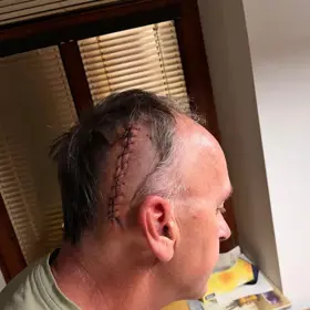 Vnuk se ho často ptá na jizvu na hlavě.