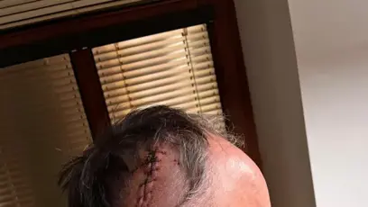 FOTO: Vnuk se ho často doptává na jizvu na hlavě.