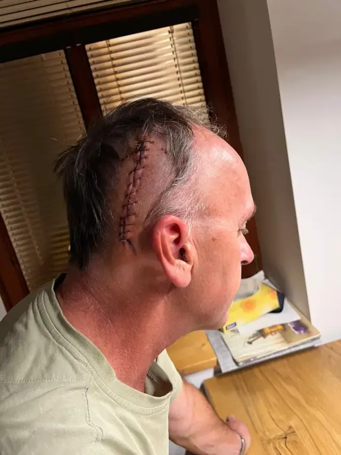 Vnuk se ho často ptá na jizvu na hlavě.