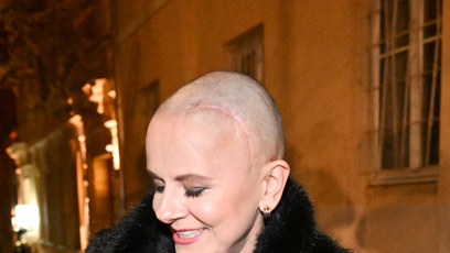 FOTO: Moderátorka a herečka Laďka Něrgešová má po operaci velikou jizvu.