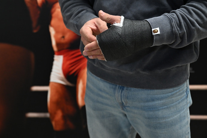 Jakub Enžl má zlomenou ruku.