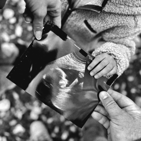 Plážová volejbalistka Markéta Sluková přidala fotku s ultrazvukem.