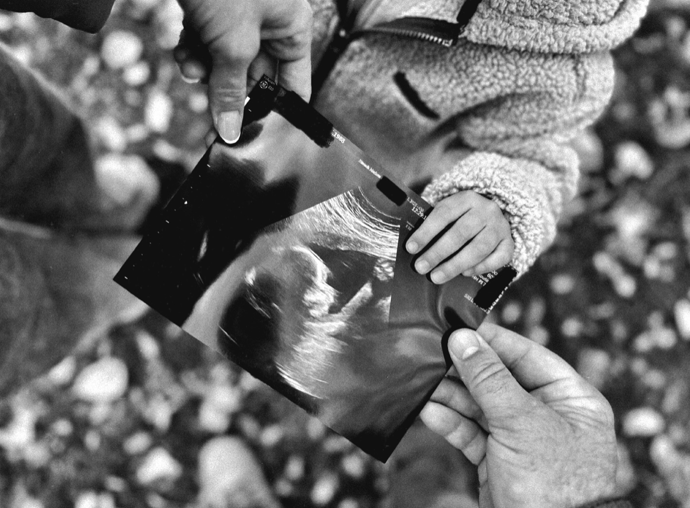 Plážová volejbalistka Markéta Sluková přidala fotku s ultrazvukem.