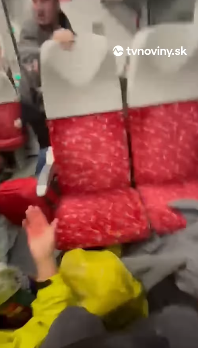 Jedné ženě tekla krev z čela.