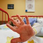 Dcera Valérie Tkadlčíkové trpí vážnou a vzácnou genetickou mutací MEN 2B. Ta způsobuje růst zhoubných nádorů, které se opakovaně vracejí.