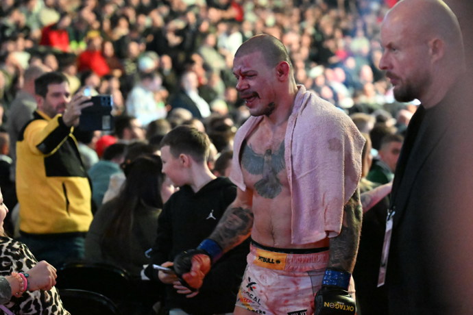 Robert Pukač byl viditelně domlácený.