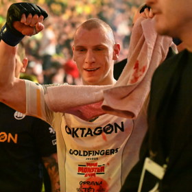 Pavel Tóth má po zápase s Raškou zlomenou čelist.