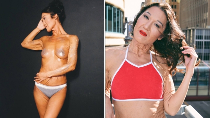 Sáře bylo deset, když jí diagnostikovali Ehlersův-Danlosův syndrom.