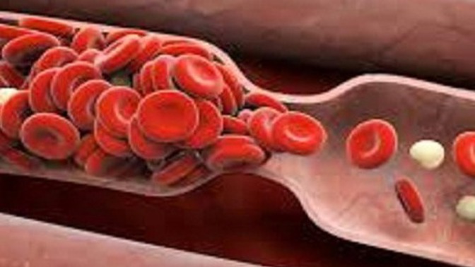 Dnes je světový den hemofilie