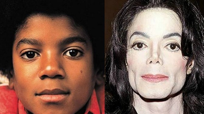 Michael Jackson měnil barvy kůže více než chameleon. Jeho touha stát se bílým mu přivodila velké zdravotní problémy