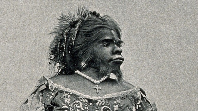 Julia Pastrana (1834 – 25. březen 1860) byla mexická zpěvačka a umělkyně, která trpěla vzácnou nemocí hypertrichózou. Ta se projevuje nadměrným růstem ochlupení. Pacientům postiženým touto chorobou se dříve říkalo vlčí či vlkodlačí lidé.