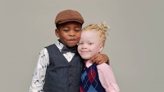 Čtyřletí sourozenci Kamsi a Kachi mají každý jinou barvu pleti. Věřili byste, že to jsou dvojčata?