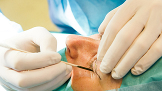 Soutěžte o operaci horních víček na klinice Esthé