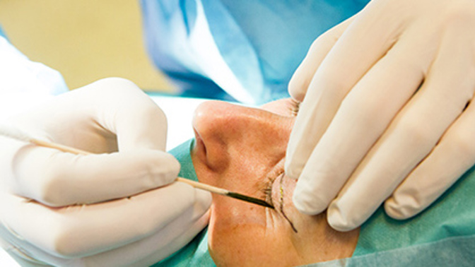 Soutěžte o operaci horních víček na klinice Esthé