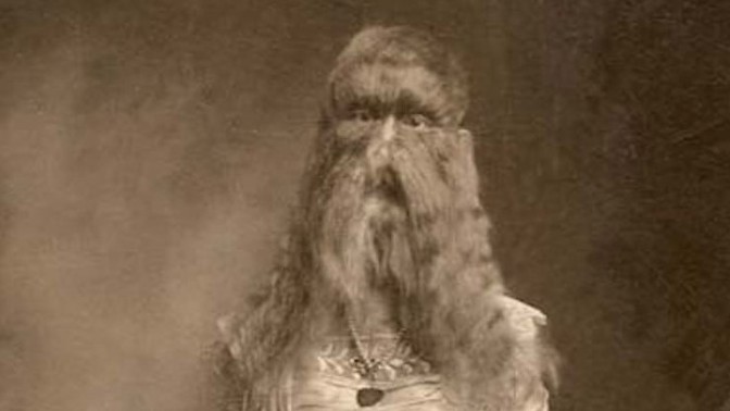 Vlčí dívka Alice Doherty: Jako hříčku přírody ji za peníze předváděli vlastní rodiče