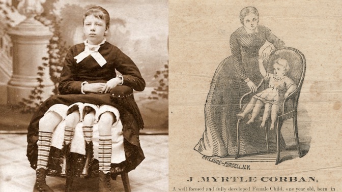 Myrtle Corbinová se narodila s postižením, které se hned tak nevidí. Ona se přesto postavila osudu