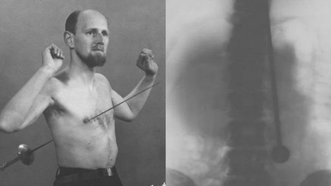 Nezranitelný Mirin Dajo si propichoval tělo a nechal si prostřelit hlavu. O život ho ale připravilo něco jiného