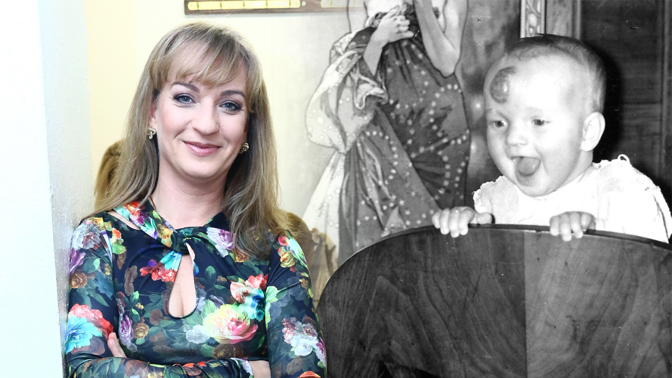 Narodila jsem se s nádorem na čele, z hlavy mi lezla mandarinka. Herečka Sandra Pogodová o traumatu z dětství
