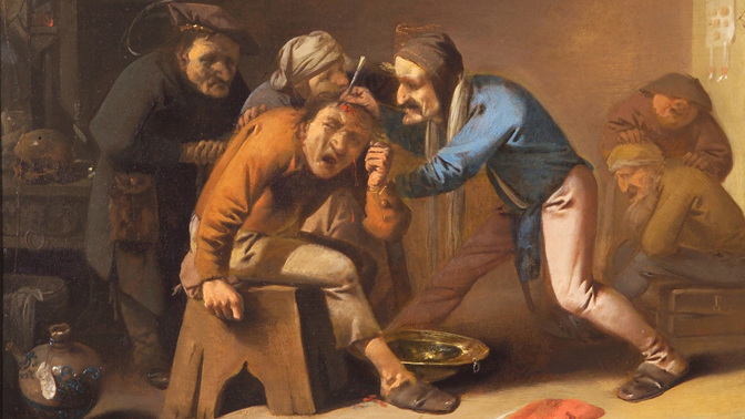 Nejbolestivější lékařské zákroky středověku: Díra do hlavy i nůž v oku