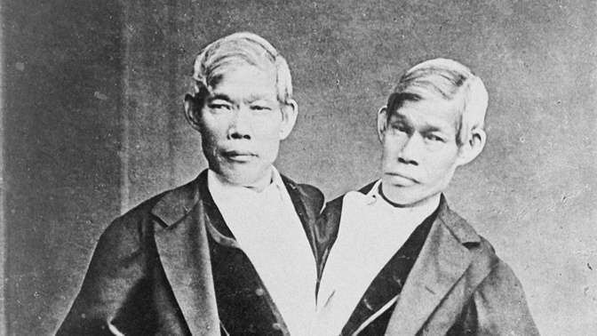 Chang a Eng Bunkerovi těžili celý život ze své odlišnosti. Ve vyšším věku se ale snažili o oddělení, což jim lékaři nedoporučili. A pitva později ukázala, že dobře udělali. Bratři by rozdělení nepřežili