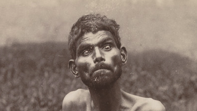 Vlčí chlapec Dina Sanichar: Do konce života jen vrčel, vyl a kouřil cigarety