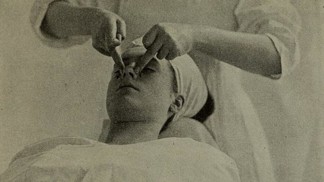 Bizarní historie léčby akné: Proč jsou eunuši ve výhodě a zabíralo krokodýlí maso nebo olovo?