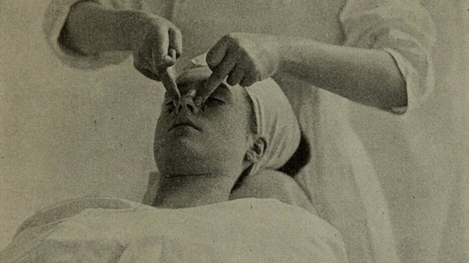 Bizarní historie léčby akné: Proč jsou eunuši ve výhodě a zabíralo krokodýlí maso nebo olovo?