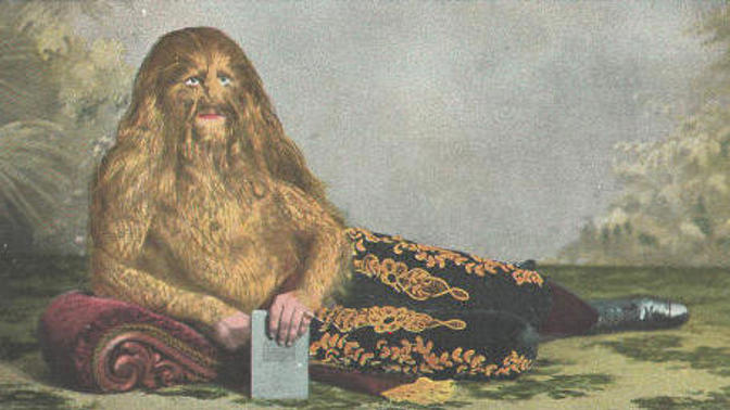 Lví muž: Polák postižený vlkodlačí nemocí si liboval v chlupech a chtěl být zubařem