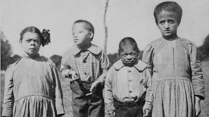 Bizarní americké zákony o ošklivosti: Z ulic měly dostat postižené, chudé a Italy