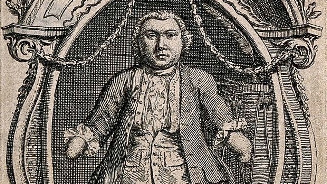 Matthew Buchinger: Neměl ruce ani nohy, zato 4 manželky, 14 dětí a prý až 70 milenek