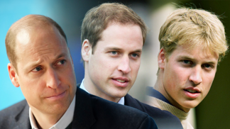 Nejslavnější vtípky prince Williama o plešatění: Kadeřníkům už moc kšeft neudělám, účes zvládnu žiletkou