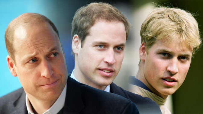 Nejslavnější vtípky prince Williama o plešatění: Kadeřníkům už moc kšeft neudělám, účes zvládnu žiletkou
