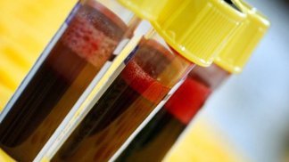 Zhubněte podle krevní skupiny. Stačí mít ten správný jídelníček!