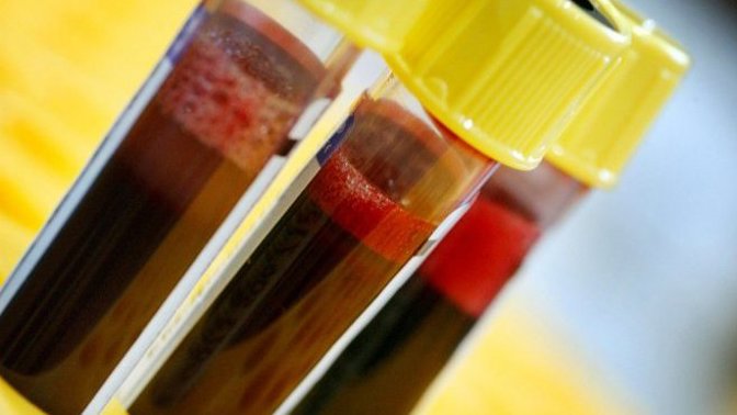 Zhubněte podle krevní skupiny. Stačí mít ten správný jídelníček!